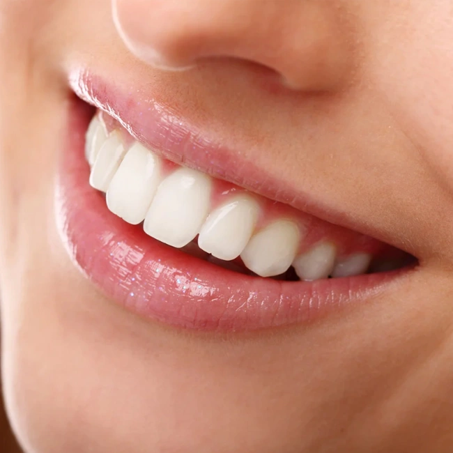 Close-up of person smiling, displaying bright white healthy teeth and pink lips.