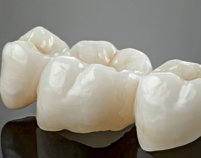 Dental crowns displayed on reflective surface showing ceramic restoration tooth replacements