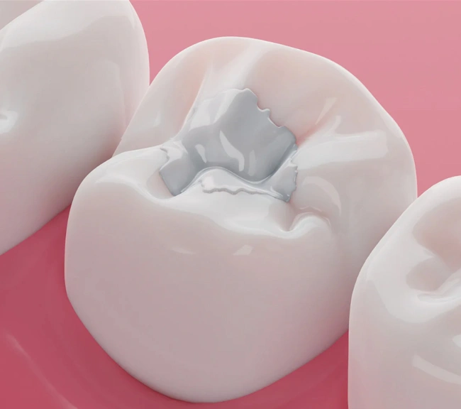 White tooth model with cavity damage displayed against pink background for dental education.